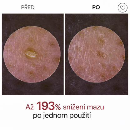 Dr melaxin Peel shoot