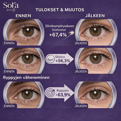 Soléa 360° Silmänympärysmaski